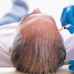 Old man visiting young male doctor in hair transplantation