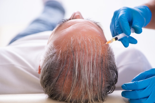 Old man visiting young male doctor in hair transplantation